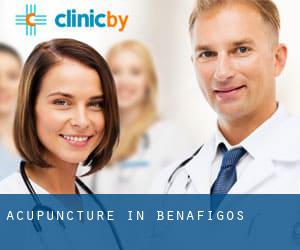 Acupuncture in Benafigos