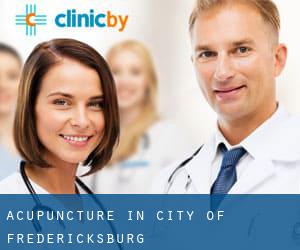 Acupuncture in City of Fredericksburg