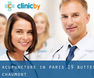 Acupuncture in Paris 19 Buttes-Chaumont